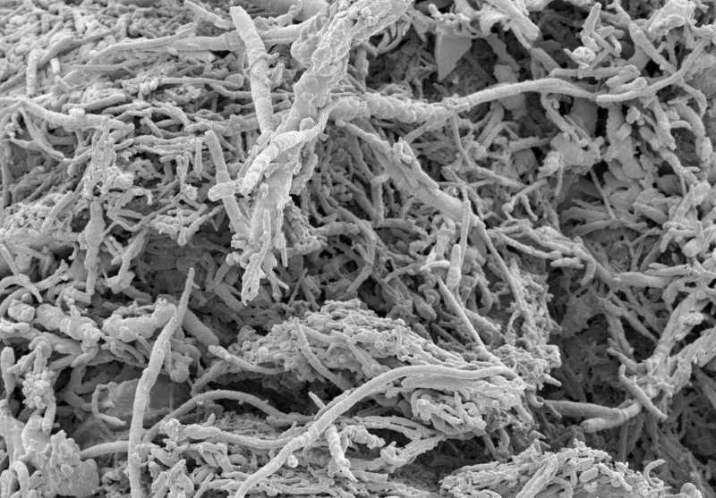 Image of household dust under a microscope